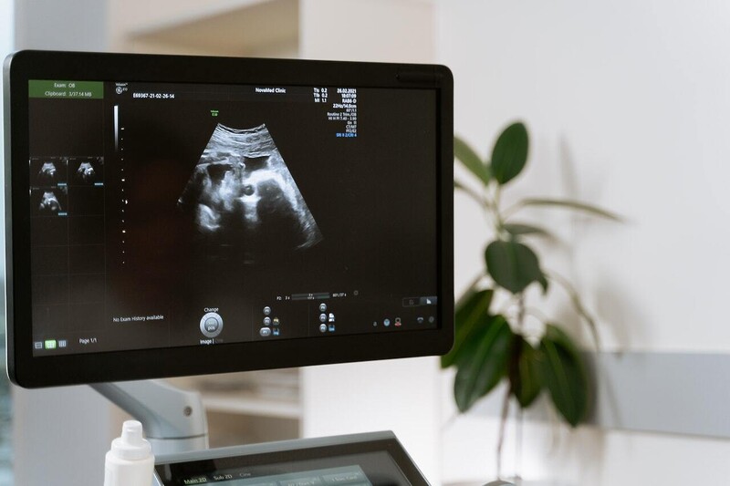 ultrasound computer